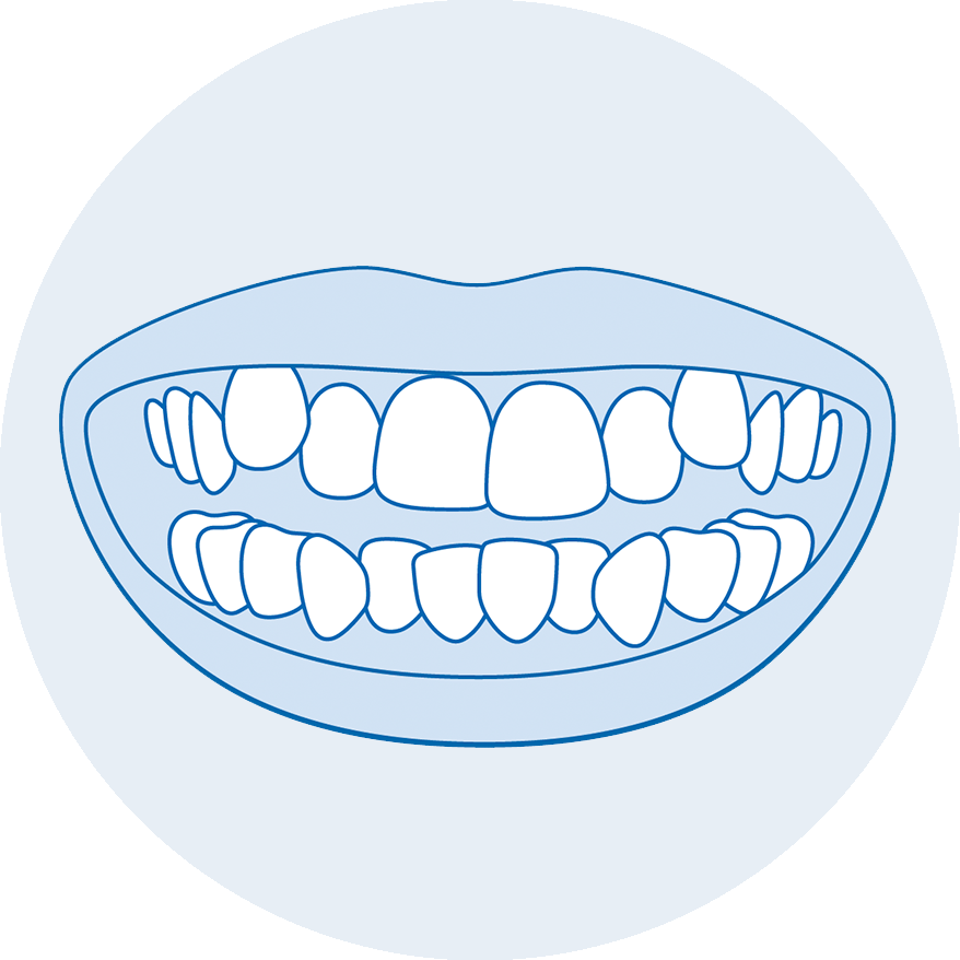 I denti possono spostarsi in età adulta?